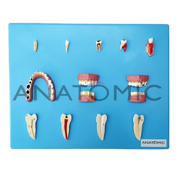 Patologia Dentária com 12 Peças