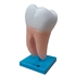 Dente Molar Ampliado - Saudável e com Cárie
