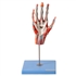 Mão Muscular com Principais Vasos e Nervos, em 5 Partes