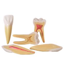 Dentes Ampliados - Canino, Incisivo e Molar - TGD-0311-A